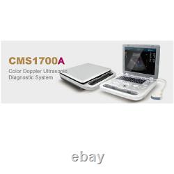 CMS1700A color Doppler ultrasonic diagnostic Scanner with USB, 3.5 Convex Probe