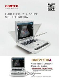 CMS1700A color Doppler ultrasonic diagnostic Scanner with USB, 3.5 Convex Probe