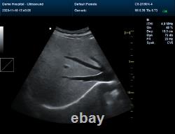 CMS1700B Color Doppler CF Ultrasound Scanner Machine USG Phased Convex Probe USG