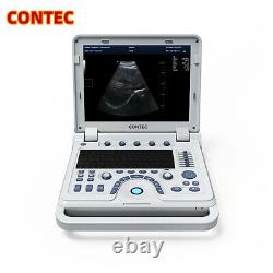 CMS1700B-VET Color Doppler Portable Ultrasound Scanner Machine with Convex Probe