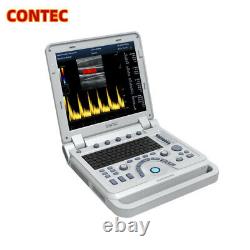CMS1700B-VET Color Doppler Portable Ultrasound Scanner Machine with Convex Probe