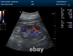 CMS1700B-VET Color Doppler Portable Ultrasound Scanner Machine with Convex Probe