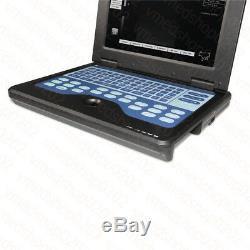 CMS600P2 CONTEC Veterinary Ultrasound Scanner Portable Laptop Machine, 7.5 Rectal