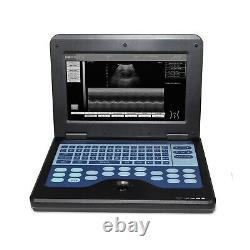 CMS600P2 Digital Portable Ultrasound Machine Laptop Scanner +Convex + Linear USA