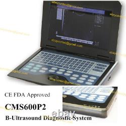 CMS600P2 Digital Ultrasound Scanner 10.1 Portable Laptop Machine Linear probe