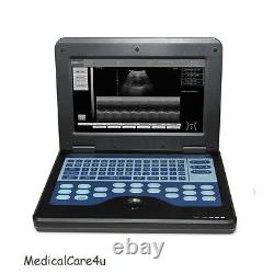 CMS600P2 Digital Ultrasound Scanner Laptop Diagnostic Machine 3.5M Convex Probe