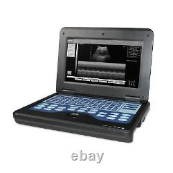 CMS600P2 Handheld Ultrasound Scanner Laptop Machine 2 Probes Cardiac+Linear, USA