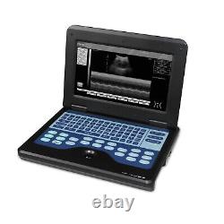 CMS600P2 Portable Ultrasound Scanner Laptop Ultrasound Machine Convex Probe FDA