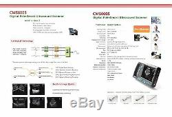 CMS600S Palmsmart Digital Ultrasound Scanner Diagnostic Machine 3.5 Convex Probe