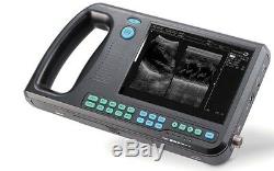 CMS600S Palmsmart Digital Ultrasound Scanner Diagnostic Machine 3.5 Convex Probe