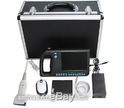 CMS600S Portable Ultrasound Scanner Handheld Digital Machine, Convex, USB, Video