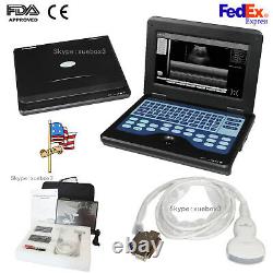 CONTEC 600P2 Portable Laptop Machine Digital Ultrasound Scanner, Convex probe USA