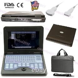 CONTEC CE FDA Portable Ultrasound Scanner Laptop Machine 2 Probes Convex&Linear