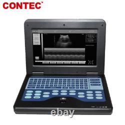 CONTEC CE FDA Portable Ultrasound Scanner Laptop Machine 2 Probes Convex&Linear