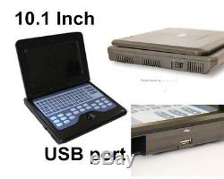 CONTEC CMS600P2 Full Digital Laptop Portable Ultrasound Scanner Machine+3 Probes