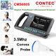 Contec Cms600s Digital Palm Smart Ultrasound Scanner Handheld 3.5 Convex Probe