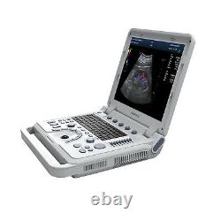 CONTEC Color Doppler Ultrasonic Diagnostic CF PW Ultrasound Scanner+Convex Probe