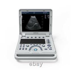 CONTEC Color Doppler Ultrasonic Diagnostic CF PW Ultrasound Scanner+Convex Probe