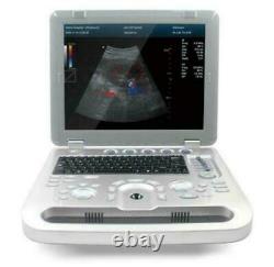 CONTEC Color Doppler Ultrasound Scanner Portable Machine with Convex Probe NEW