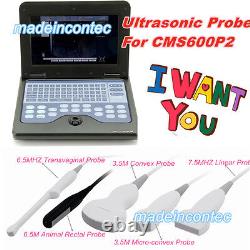 CONTEC Convex/Transva-/Linear/Rectal/Micro-Convex Probes For Ultrasound Scanner
