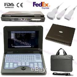 CONTEC Human Ultrasound Scanner with Three Probes Linear Convex and Micro Convex