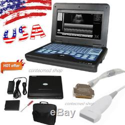 CONTEC Portable Full Digital Ultrasound Scanner Machine+7.5 Mhz Linear Probe USA
