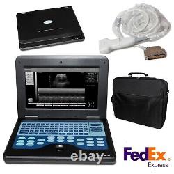 CONTEC Portable Laptop Machine Digital Ultrasound Scanner, 7.5 MHZ Linear Probe