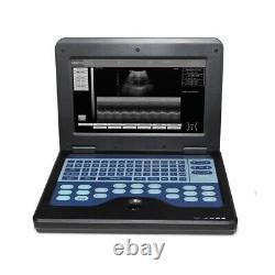 CONTEC Portable Laptop Ultrasound Scanner Machine Convex +Linear Probe CMS600P2