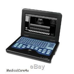 CONTEC Ultrasound Scanner Laptop Machine Diagnostic Systems 3.5Mhz Convex Probe