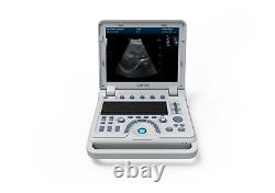 CONTEC Ultrasound Scanner Laptop Machine PW Doppler pseudo-color function Convex