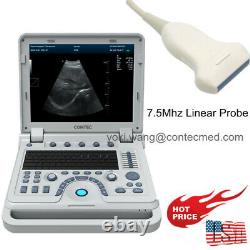 CONTEC Ultrasound Scanner Laptop PW Doppler Pseudo-color Function 7.5Mhz Linear