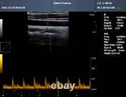 CONTEC Ultrasound Scanner Laptop PW Doppler Pseudo-color Function 7.5Mhz Linear