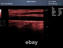 CONTEC Ultrasound Scanner Laptop PW Doppler Pseudo-color Function 7.5Mhz Linear