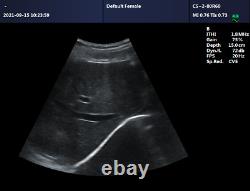 CONTEC Ultrasound Scanner Laptop PW Doppler Pseudo-color Function 7.5Mhz Linear