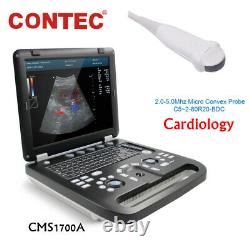 Cardiac Color Doppler Ultrasound Scanner Laptop Machine Micro-Convex Heart Exam
