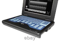 Cardiac Ultrasound scanner Portable/Laptop machine Ultrasonic diagnostic system