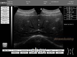 Cardiac Ultrasound scanner Portable/Laptop machine Ultrasonic diagnostic system