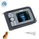Carejoy 5.5 Digital Handheld Palmsmart Ultrasound Scanner+7.5mhz Linear Probe