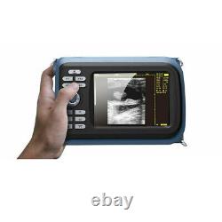 Carejoy 5.5'' Handheld Ultrasound Machine Scanner Digital+Convex Probe Human A++