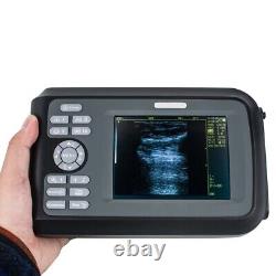 Carejoy 5.5 Inch Handheld Digital Ultrasound Scanner +Transvaginal Probe