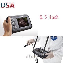 Carejoy 5.5 LCD Digital Ultrasound Scanner Human+Convex Probe Handheld US NEW