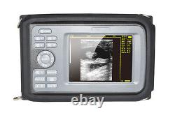 Carejoy 5.5 LCD Digital Ultrasound Scanner Human+Convex Probe Handheld US NEW