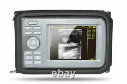 Carejoy 5.5'' Veterinary Digital Ultrasound Scanner Machine+Rectal Probe Set