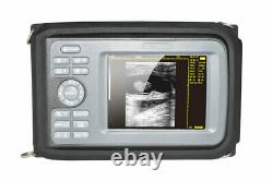 Carejoy Digital 5.5 inch Handheld Ultrasound Scanner Machine+Linear Probe