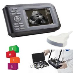 Carejoy Digital Handheld Handheld Ultrasound Scanner Machine+3.5MHZ Convex Probe