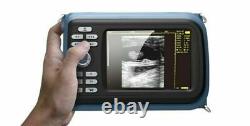 Carejoy Digital Handheld Handheld Ultrasound Scanner Machine+3.5MHZ Convex Probe