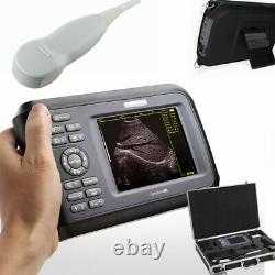 Carejoy Digital Handheld Ultrasound Machine Scanner+5Mhz Micro-Convex Human Use