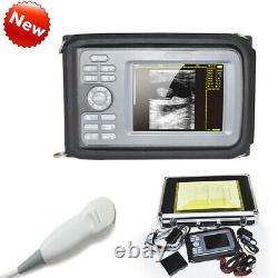 Carejoy Digital Handheld Ultrasound Machine Scanner+5Mhz Micro-Convex Human Use