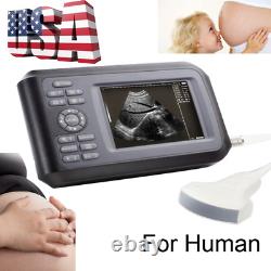 Carejoy Digital LCD Ultrasound Scanner Machine Human Use+R40 3.5Mhz Convex Probe