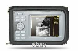 Carejoy Digital LCD Ultrasound Scanner Machine Human Use+R40 3.5Mhz Convex Probe